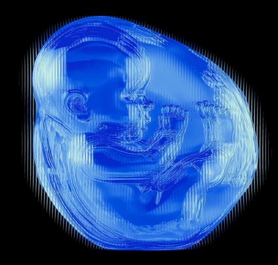 OB/GYN ultrasound course artwork